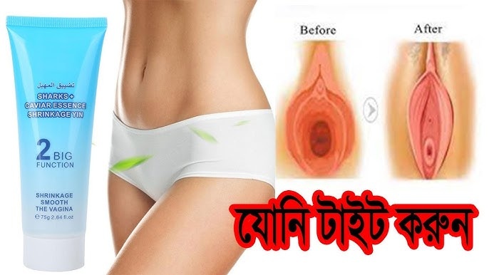 shrinkage  compact the vagina